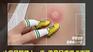 999皮炎平世界杯：止痒想要快人一步，传奇只求慢点谢幕